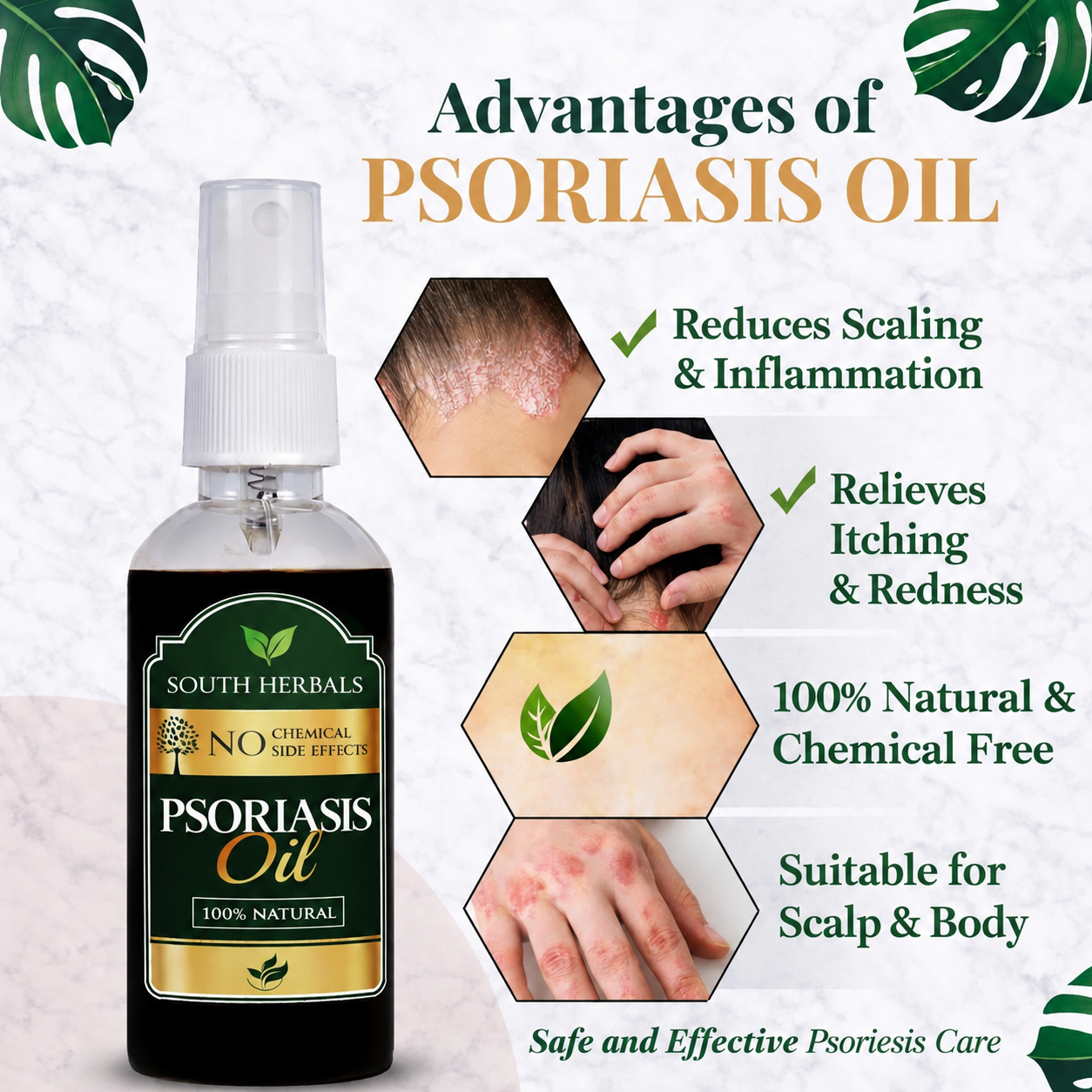 south Herbal Psoriasis Oil-Advanced Psoriasis Clearing Oil
