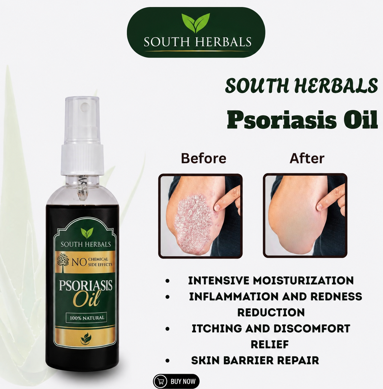 south Herbal Psoriasis Oil-Advanced Psoriasis Clearing Oil
