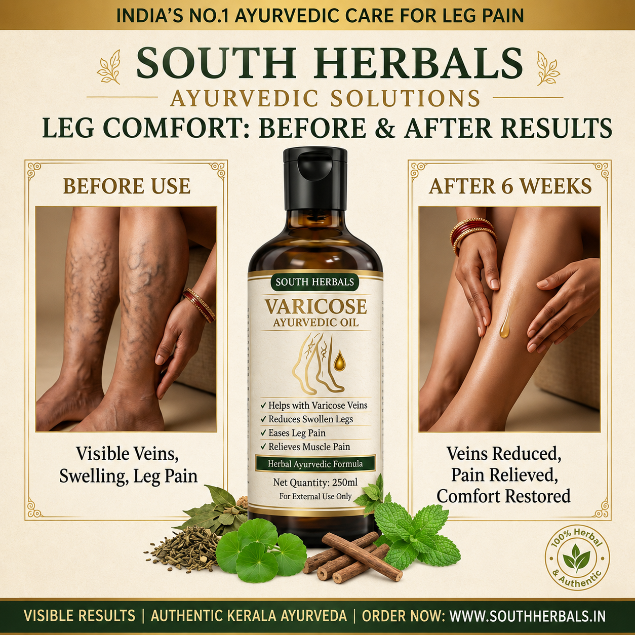 VARICOSE VEINS PAIN RELIEF OIL - Ayurveda Oil Relief 60 Days Challenge